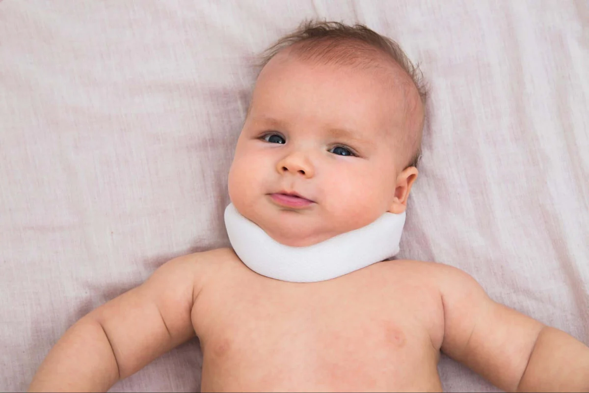 Torticollis: Penyebab, Gejala, dan Cara Mengatasinya