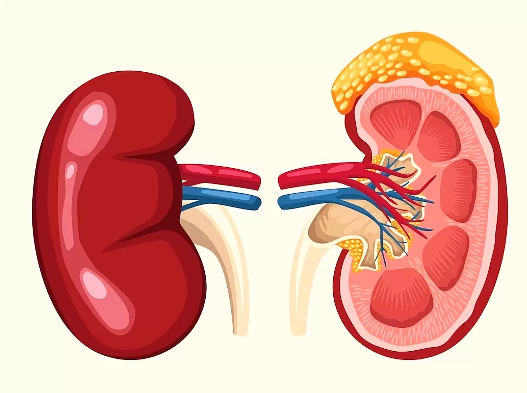Glomerulonefritis: Penyakit Ginjal yang Perlu Diwaspadai