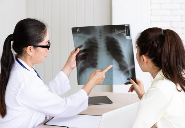 Pneumothorax